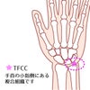 竹虎　ソフラウルファーTFCC　1枚8